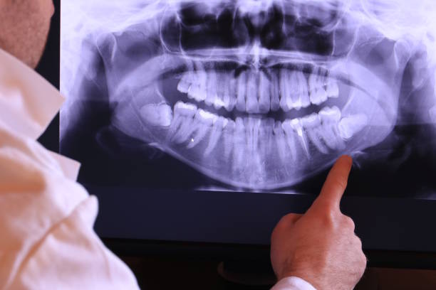 Best 24-Hour Emergency Dental Care in Stamford, TX